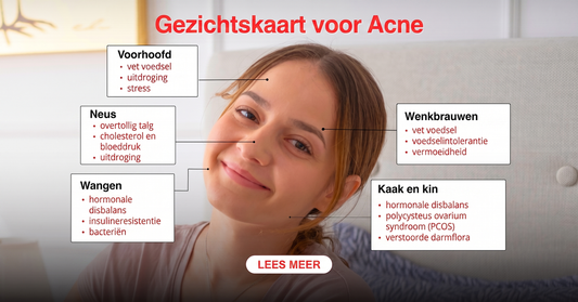 Acne-gezichtskaart: puistjes per gezichtszone