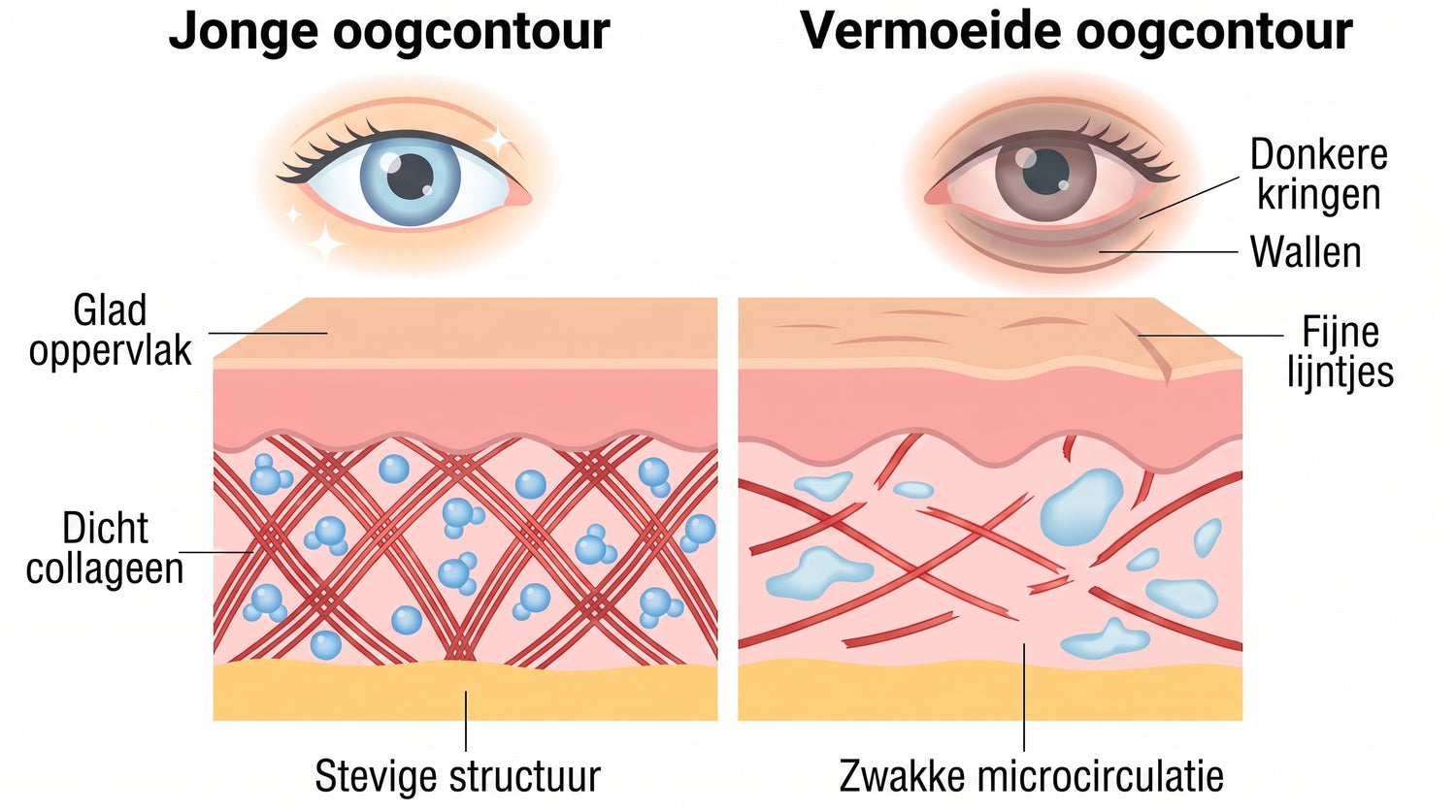 Rose Eye Lift NL eyev1