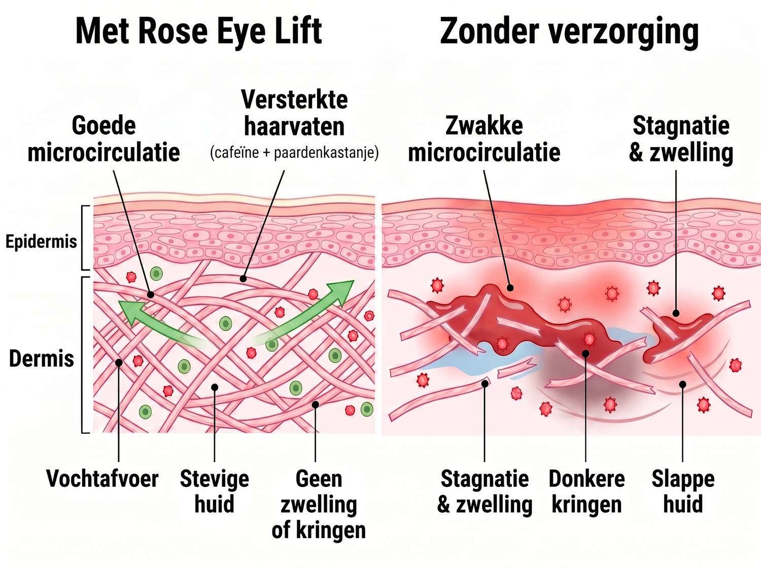 Rose Eye Lift NL t17