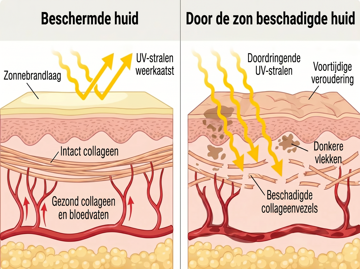 spf NL infographic